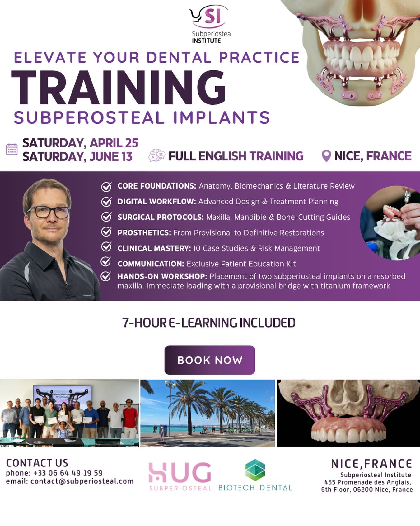 Elevate Your Clinical Expertise with Subperiostea Institute 🦷

Are you ready to master advanced implantology? Join us in the beautiful city of Nice, France, for an intensive training session on Subperiosteal Implants. 

📅 Dates: Saturday, April 25 or Saturday, June 13
📍 Location: Nice, France 🌴☀️
🎓 7 hours of E-Learning!
🛠️ Hands-on: Practice placement on a resorbed maxilla with immediate loading protocols.

Don’t miss this opportunity to refine your surgical skills and offer new solutions to your patients ! 

📩 Ready to upgrade your practice? Contact us today at contact@subperiosteal.com or call +33 6 64 49 19 59 to secure your spot! 

#SubperiostealImplants #Implantology #OralSurgery #DentalTraining #DentalEducation DigitalDentistry